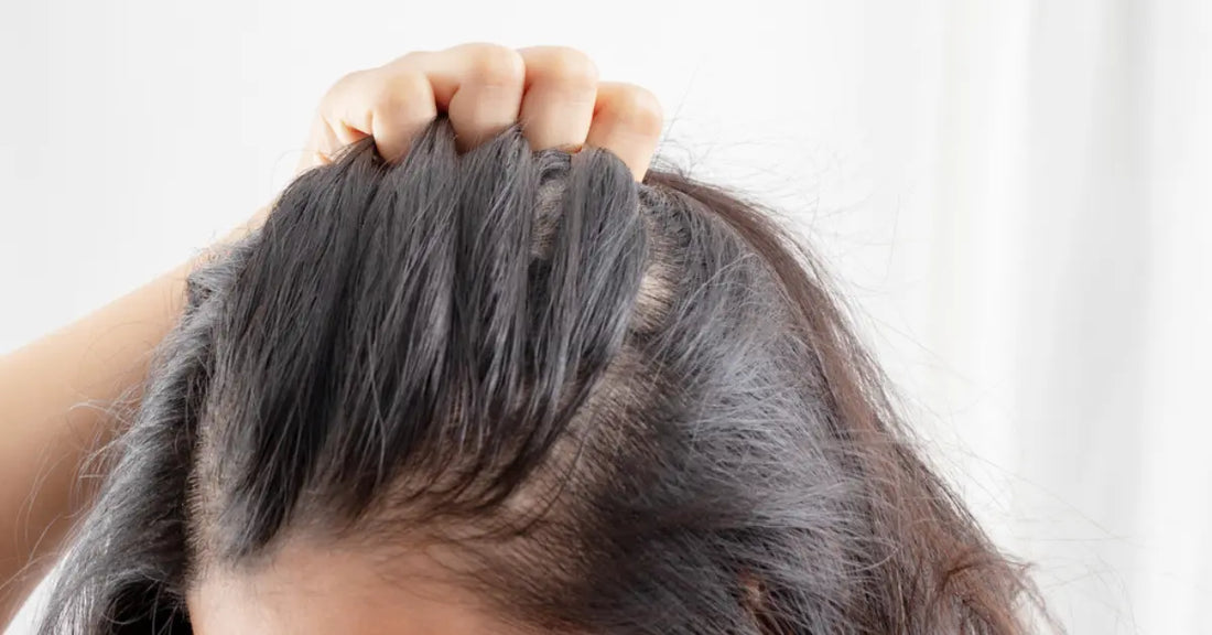 Person checking scalp dandruff and hair shedding while caring for irritated hair and scalp conditions