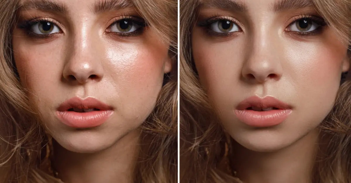 Before and after results of an effective Large pores treatment