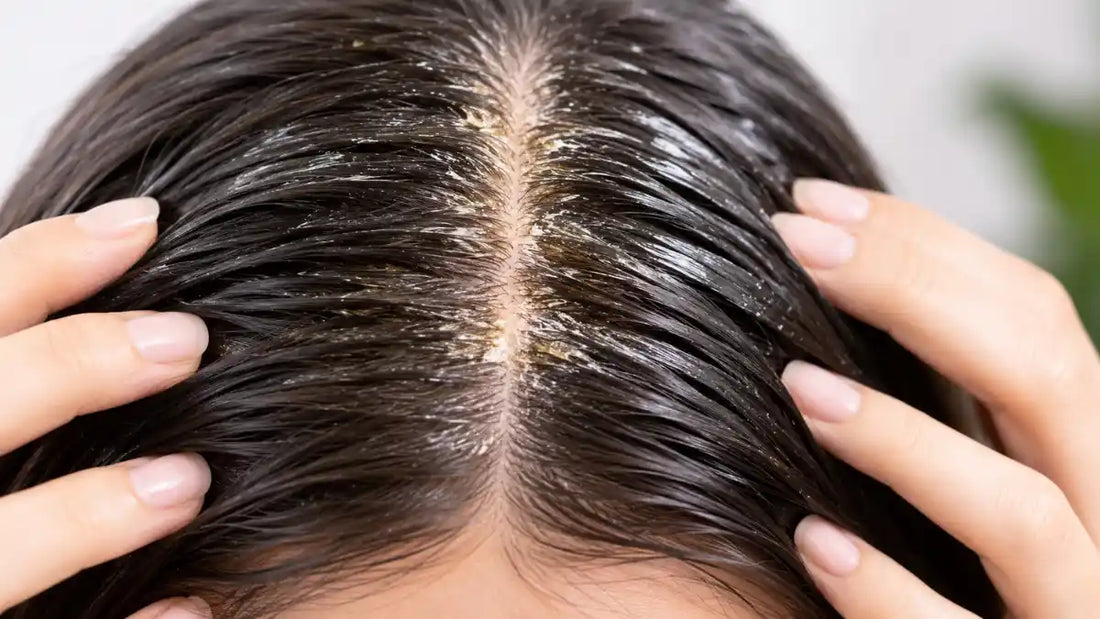 Woman examining her scalp showing mild Scalp Buildup with healthy hair in natural lighting.