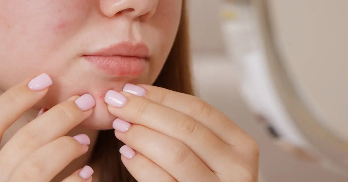 A woman applying a calming serum as part of her Sensitive Skin Care Routine