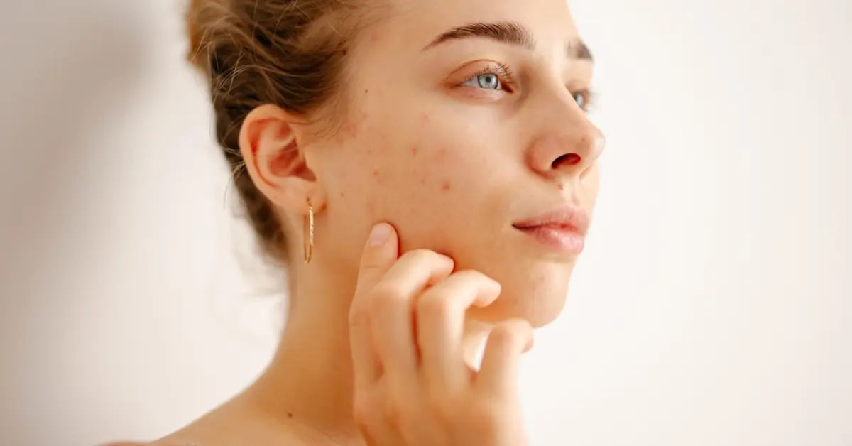 Gentle Sensitive skin care for a calm and healthy glow
