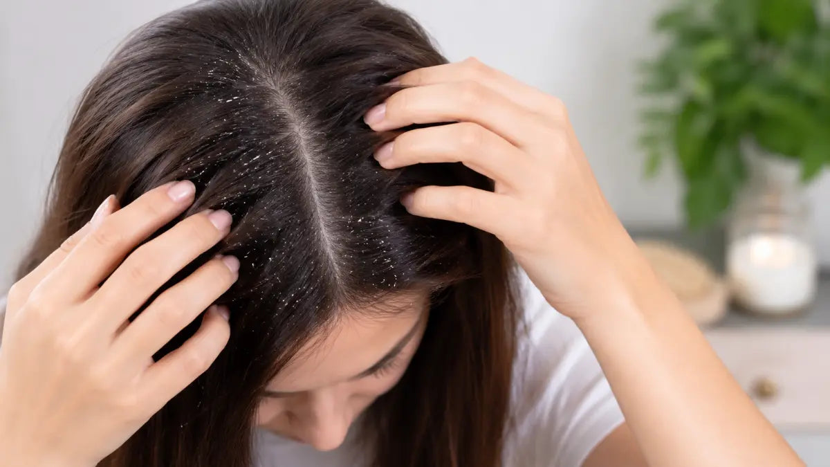Healthy scalp illustrates why dandruff comes back and how proper scalp care helps reduce recurring flakes.